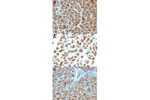 Immunohistochemical staining (Formalin-fixed paraffin-embedded sections) of human pancreas (A), rat pancreas (B) and mouse pancreas (C) with ELA3B monoclonal antibody, clone CELA3B/1257 . (Elastase 3B antibody  (AA 82-238))