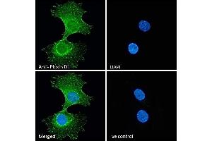 Immunofluorescence (IF) image for anti-Plexin D1 (PLXND1) (Internal Region) antibody (ABIN185358)