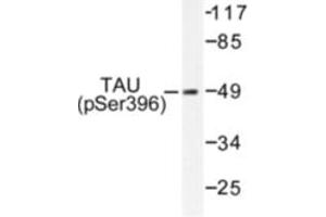 Image no. 1 for anti-Microtubule-Associated Protein tau (MAPT) (pSer396) antibody (ABIN318142)