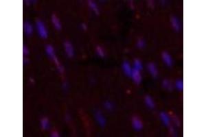 Immunofluorescence analysis of Mouse heart tissue using CD5 Monoclonal Antibody at dilution of 1:200. (CD5 antibody)