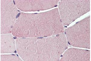 Anti-TXLNB antibody  ABIN960834 IHC staining of human skeletal muscle. (Taxilin beta antibody  (Internal Region))