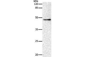 Western blot analysis of Hela cell, using DRD1 Polyclonal Antibody at dilution of 1:500 (Dopamine Receptor d1 antibody)