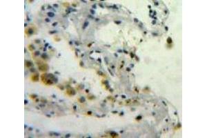 Used in DAB staining on fromalin fixed paraffin-embedded Lung tissue (SPARC antibody  (AA 18-301))