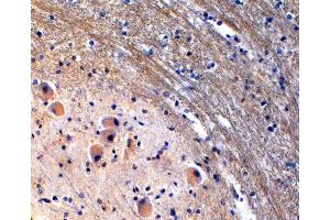 (ABIN185533) (2 μg/mL) staining of paraffin embedded Human Brain Stem. (Tryptophan Hydroxylase 2 antibody  (Internal Region))