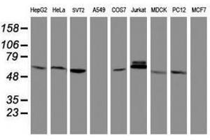 Image no. 8 for anti-Metalloproteinase Inhibitor 2 (TIMP2) antibody (ABIN1501393)
