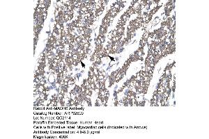 Human Heart (SMAD6 antibody  (N-Term))