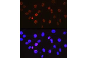 Immunofluorescence analysis of NIH-3T3 cells using Cyclin H Rabbit mAb (ABIN7266569) at dilution of 1:100 (40x lens). (Cyclin H antibody)