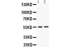 Western blot analysis of VRK1 expression in rat thymus extract (lane 1) and JURKAT whole cell lysates (lane 2). (VRK1 antibody  (C-Term))