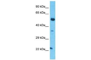 Host:  Rabbit  Target Name:  TCEAL5  Sample Type:  Thymus Tumor lysates  Antibody Dilution:  1. (TCEAL5 antibody  (Middle Region))