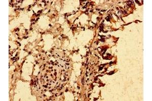 Immunohistochemistry of paraffin-embedded human lung tissue using ABIN7151248 at dilution of 1:100 (TRIM21 antibody  (AA 1-475))