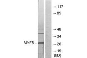 Western blot analysis of extracts from HepG2 cells, using MYF5 Antibody. (MYF5 antibody  (AA 61-110))
