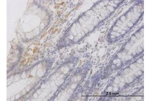 Image no. 1 for anti-RAB42, Member RAS Oncogene Family (RAB42) (AA 46-106) antibody (ABIN599320) (RAB42 antibody  (AA 46-106))
