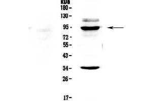Western blot analysis of BRD7 using anti-BRD7 antibody .