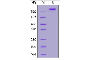 Biotinylated SARS-CoV-2 Spike Trimer, His,Avitag (B. (SARS-CoV-2 Spike Protein (B.1.1.529 - Omicron, Trimer) (His-Avi Tag,Biotin))