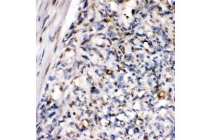 IHC analysis of ZEB1 using anti-ZEB1 antibody (ABIN7602984). (ZEB1 antibody  (Middle Region))
