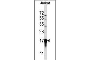Western blot analysis in Jurkat cell line lysates (35ug/lane). (PFDN5 antibody  (AA 79-108))