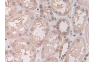 Detection of GCA in Human Kidney Tissue using Polyclonal Antibody to Grancalcin (GCA) (Grancalcin antibody  (AA 1-139))