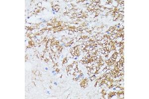 Immunohistochemistry of paraffin-embedded mouse spinal cord using CTNN antibody (ABIN7266134) at dilution of 1:100 (40x lens). (CTNNA2 antibody  (AA 150-300))
