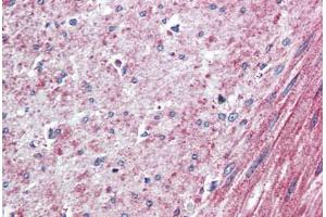 Human Colon, Smooth Muscle (formalin-fixed, paraffin-embedded) stained with ELTD1 antibody ABIN410769 followed by biotinylated goat anti-rabbit IgG secondary antibody ABIN481713, alkaline phosphatase-streptavidin and chromogen. (ELTD1 antibody  (N-Term))