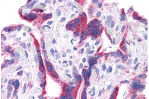 Human Placenta: Formalin-Fixed, Paraffin-Embedded (FFPE) (DLL1 antibody  (N-Term))