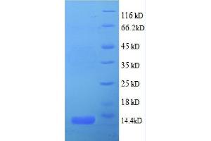 Chemokine (C-X-C Motif) Ligand 5 (CXCL5) (AA 37-110), (partial) protein (His tag) (CXCL5 Protein (AA 37-110, partial) (His tag))