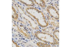 Immunohistochemistry of paraffin-embedded human kidney using IFNB1 antibody at dilution of 1:200 (x400 lens)