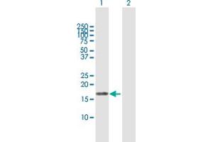 Western Blot analysis of EIF5A2 expression in transfected 293T cell line by EIF5A2 MaxPab polyclonal antibody. (EIF5A2 antibody  (AA 1-153))