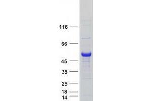 Validation with Western Blot (EIF2B3 Protein (Myc-DYKDDDDK Tag))
