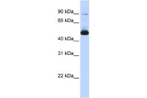 WB Suggested Anti-KRT16 Antibody Titration: 0. (KRT16 antibody  (Middle Region))