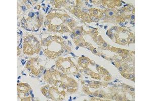 Immunohistochemistry of paraffin-embedded Human stomach using SLC30A1 Polyclonal Antibody (SLC30A1 antibody)