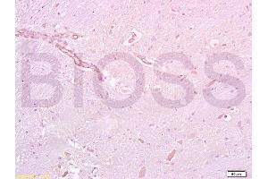 Formalin-fixed and paraffin embedded rat brain tissue labeled with Anti-GLP-1R Polyclonal Antibody, Unconjugated (ABIN731333) at 1:200 followed by conjugation to the secondary antibody and DAB staining (GLP1R antibody  (AA 101-200))