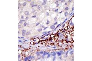 Image no. 2 for anti-Ring Finger Protein 216 (RNF216) (C-Term) antibody (ABIN357474) (RNF216 antibody  (C-Term))