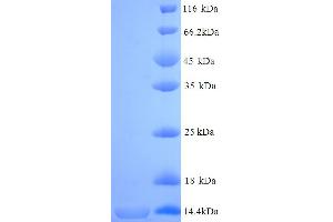 SDS-PAGE (SDS) image for L1 Cell Adhesion Molecule (L1CAM) (AA 1003-1114), (partial) protein (His tag) (ABIN4974781)