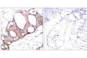 Image no. 1 for anti-Glycogen Synthase Kinase 3 alpha (GSK3a) (pSer21) antibody (ABIN196620) (GSK3 alpha antibody  (pSer21))