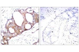 Image no. 1 for anti-Glycogen Synthase Kinase 3 alpha (GSK3a) (pSer21) antibody (ABIN196621) (GSK3 alpha antibody  (pSer21))