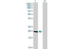Western Blot analysis of IL23A expression in transfected 293T cell line by IL23A MaxPab polyclonal antibody.