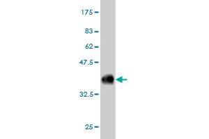 Western Blot detection against Immunogen (36. (COQ8A antibody  (AA 1-100))