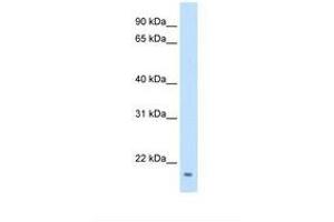 Image no. 1 for anti-Family with Sequence Similarity 107, Member A (FAM107A) (C-Term) antibody (ABIN320713) (FAM107A antibody  (C-Term))