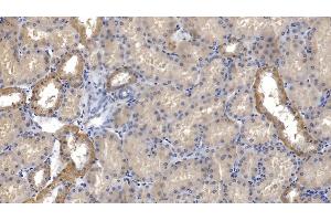Immunohistochemistry (IHC) image for anti-Sodium Potassium ATPase, alpha1 (ATP1A1) (AA 493-660) antibody (ABIN7428587)