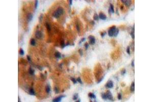 Used in DAB staining on fromalin fixed paraffin-embedded Stomach tissue (MUC4 antibody  (AA 1154-1309))