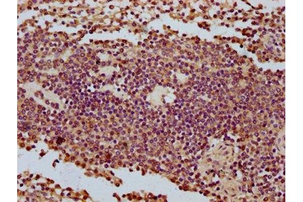 CCDC56 antibody  (AA 2-57)