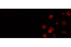 ABIN6274505 staining Hela cells by IF/ICC. (XRN2 antibody  (N-Term))