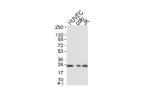 Western blot analysis of extracts from HUVEC cells (Lane 1), colo cells (Lane 2) and JK cells (Lane 3), using Caveolin-1 Antibody. (Caveolin-1 antibody)