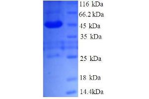 TMED9 Protein (AA 40-197, partial) (GST tag)