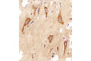 Immunohistochemical analysis of paraffin-embedded H. (VAMP8 antibody  (N-Term))
