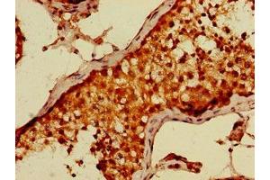 Immunohistochemistry of paraffin-embedded human testis tissue using ABIN7149691 at dilution of 1:100 (CDT2/RAMP antibody  (AA 393-550))