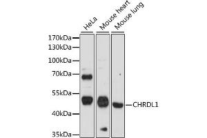 Western blot analysis of extracts of various cell lines, using CHRDL1 antibody (ABIN7266351) at 1:1000 dilution. (CHRDL1 antibody  (AA 289-458))
