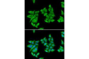 Immunofluorescence (IF) image for anti-Uroporphyrinogen Decarboxylase (UROD) antibody (ABIN1876681) (UROD antibody)