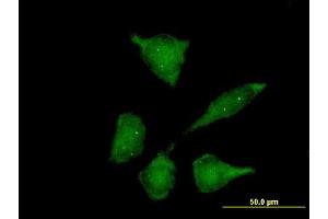 Immunofluorescence of purified MaxPab antibody to SIP1 on HeLa cell. (SIP1 antibody  (AA 1-280))