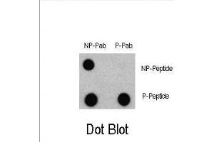 Dot blot analysis of Phospho-LC3 (G8a) - S12 Antibody 3301a and Nonphospho-LC3 (G8a) Antibody on nitrocellulose membrane.